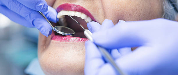 Best Urgent Care for Lost Fillings or Crowns in Reynolds Heights, PA